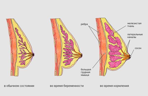 Птоз груди: какие бывают стадии, коррекция проблемы