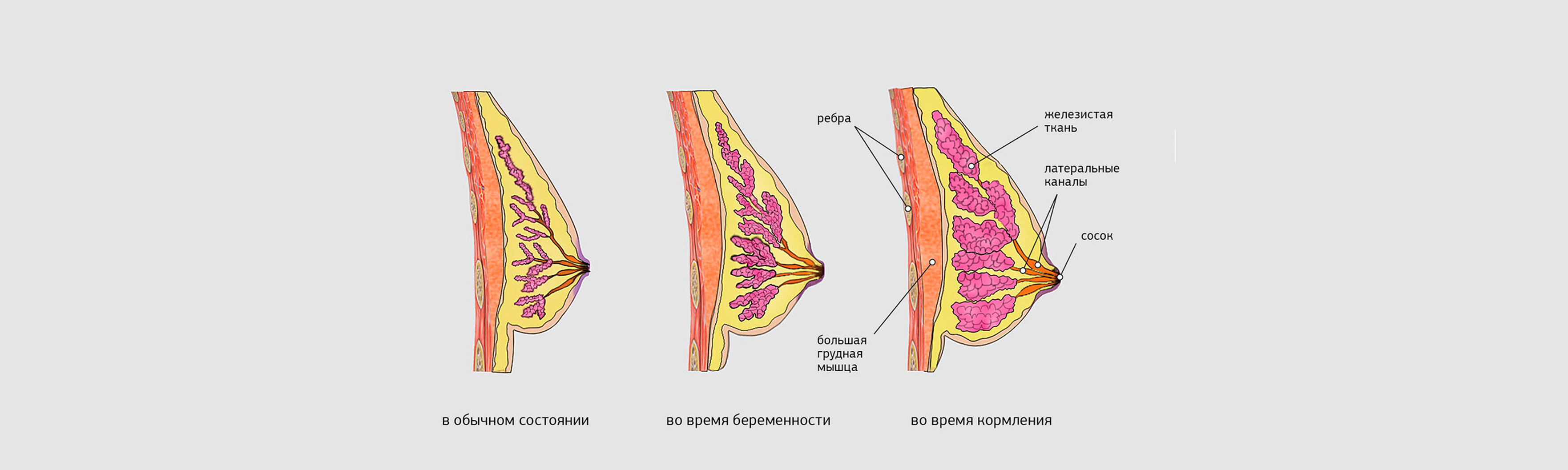 Птоз груди: какие бывают стадии, коррекция проблемы