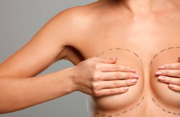В чем разница между уменьшением груди и подтяжкой