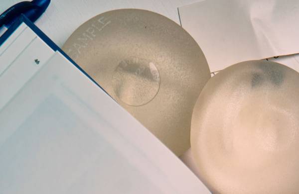 Могут ли грудные имплантаты продержаться всю жизнь? Средний срок службы грудных имплантов