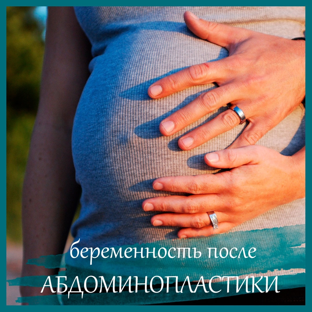 Беременность после абдоминопластики