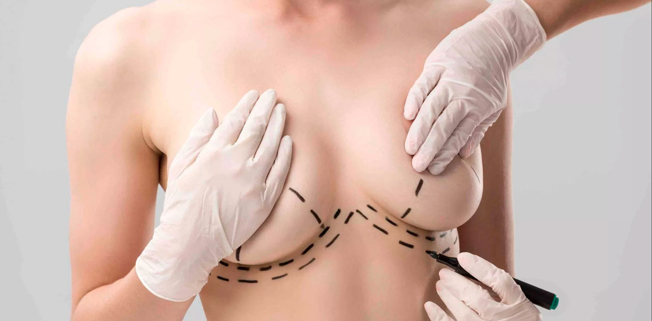 Отеки после маммопластики: как уменьшить отёк после пластики груди